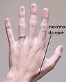 Hand – Wikimedia Commons