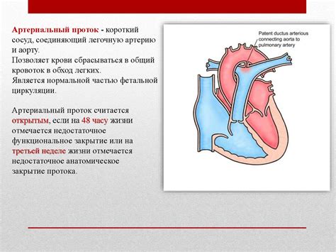 Открытый артериальный проток - презентация онлайн