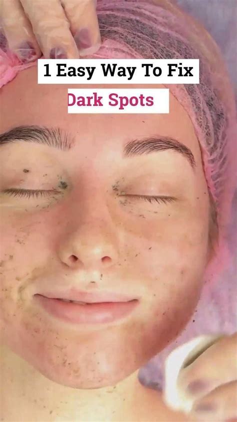 how to fade dark spots naturally at home