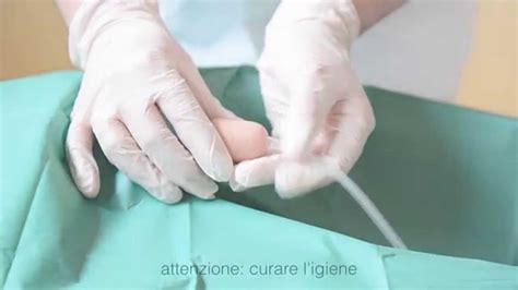 Ulss 1Belluno - Gestione del catetere vescicale a domicilio - YouTube