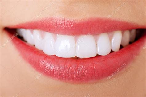 Perfect Smile Finance