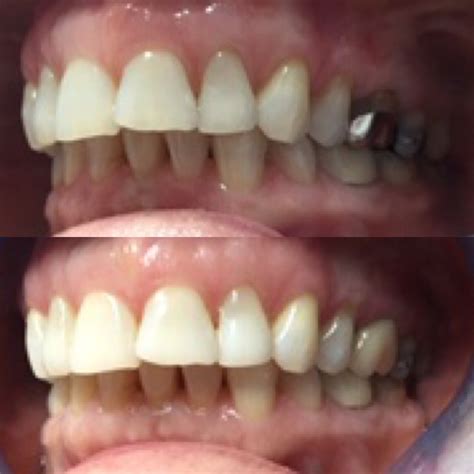 Gallery – Belgrave House Dental