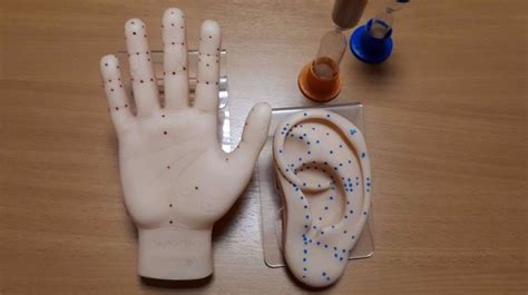 Рефлексотерапия