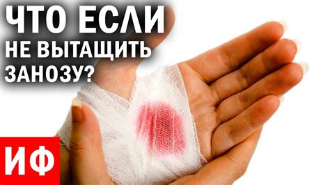 ЧТО ЕСЛИ не вытащить ЗАНОЗУ? #ИФ - YouTube