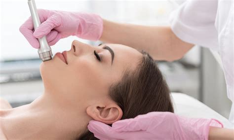 I Tried Microdermabrasion And This Is What Happened | TRAIN for HER