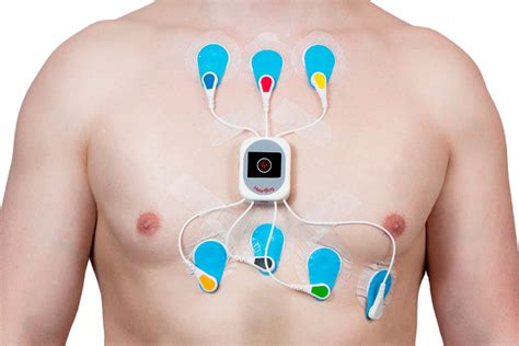 holter ecg  detectar arritmias taquicardias cardiavant