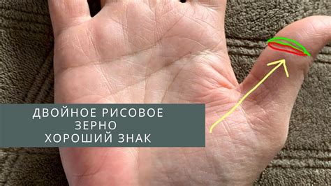 Двойное рисовое зерно на большом пальце. На фото. Хиромантия с ...