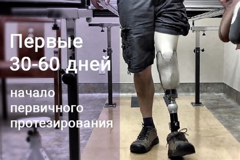 Протезы нижней конечности