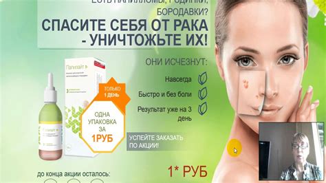 #Папилайт #Тинедол #Папиллок #Стоп Актив - обман и развод на деньги ...