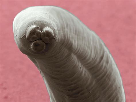Roundworms Ascaris