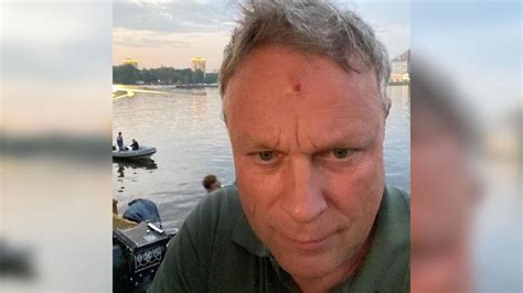 Сергей Жигунов показал ранение. В него выстрелил другой актёр
