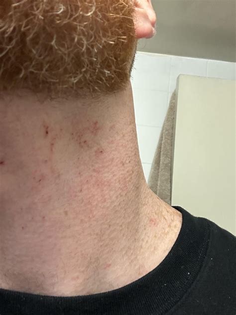 red  cut  neck  cut  shave rmalehairadvice
