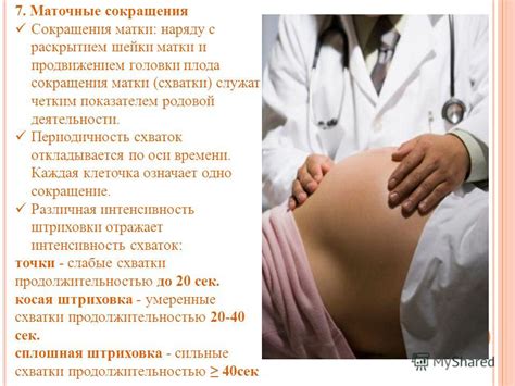 Презентация на тему: "П АРТОГРАММА. Партограмма – способ графического ...