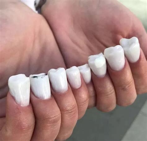 Could you fix my nails please? Nothing serious... just some caries on ...