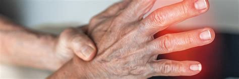 burn treatment urgent care hoffman estates schaumburg il treatment