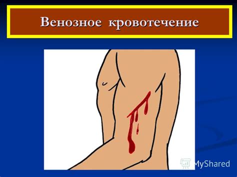 Презентация на тему: "Первая медицинская помощь при кровотечении ...