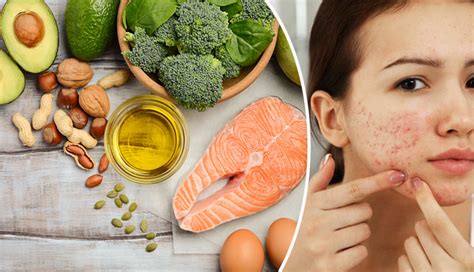 8 Foods You Should Start Eating To Prevent Acne Breakout - lifeberrys.com