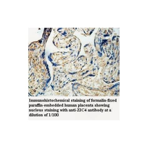 ZIC4 Antibody Supplier | CAS | AOBIOUS
