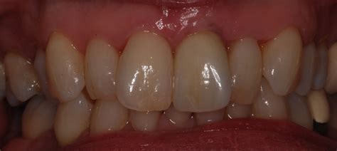 Prosthodontics & Dental Implants - Clinic 334