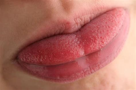 how to know if tongue is swollen