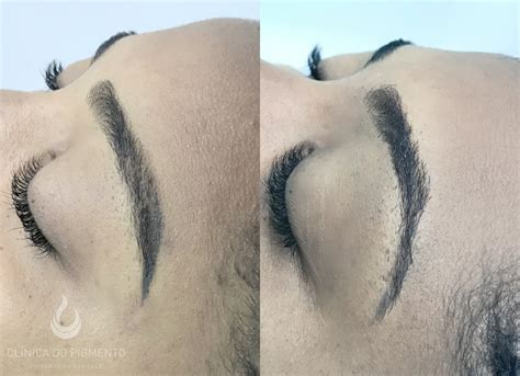 Quantos Dias Depois Da Micropigmentação Posso Lavar O Cabelo - Quantos Dias Depois Da Micropigmentação Posso Lavar O Cabelo - RETOEDU