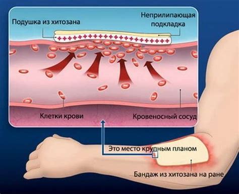 Виды и различия тактических гемостатиков (кровоостанавливающих средств ...