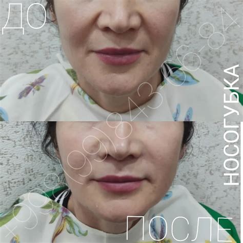 Носогубка Nosogubka 🥰 #beauty