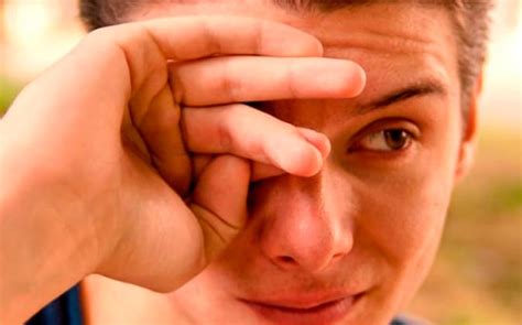 Coçar O Olho Faz Mal - Coçar os Olhos Faz Mal? - Dr Leonardo Aguiar | Oftalmologista Fortaleza