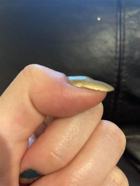 I get these dents in my nails all the time. Does anyone know how to prevent them? : r/Nails