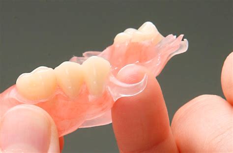 Proteze - Stomatološka poliklinika Oral B Čukić