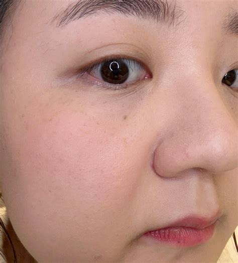 Itai Itai Disease 1