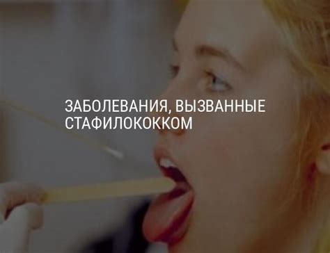 Как лечить стафилококк — заболевания, вызываемые стафилококком ...