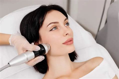 Top 5 Virtue RF Microneedling Benefits For Skin Rejuvenation