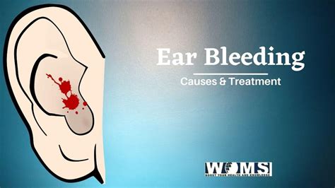 Vital Facts about Ear Bleeding in 2021 - WOMS