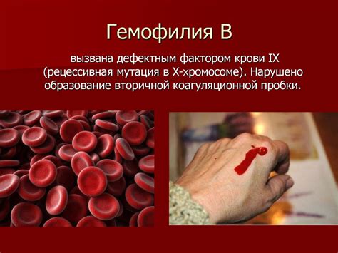 Гемофилия - презентация онлайн