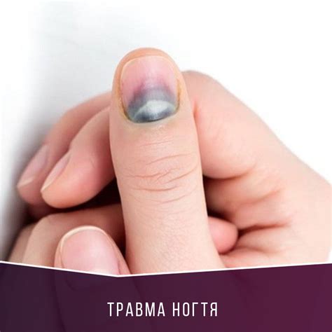 Что делать если палец