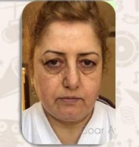 СЕСТРА МИ (40) СЕ ОМАЖИ ЗА БОГАТАШ ВО ДУБАИ, И ПЛАТИ НА ПЛАСТИЧНА ...