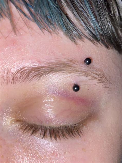 Bruised eyebrow piercing : r/piercing