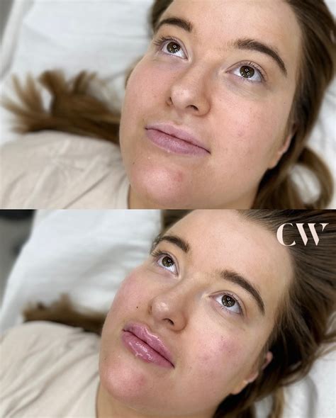 Corinne Williams Tailored Medical Aesthetics - Reasons why you you