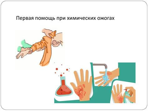 Оказание первой помощи при ожогах и отморожениях - online presentation