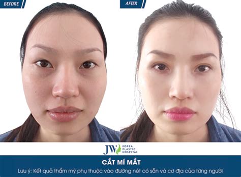 Rất Hay: Mắt 2 mí là mắt như thế nào? Bí quyết sở hữu mắt 2 mí đẹp long ...