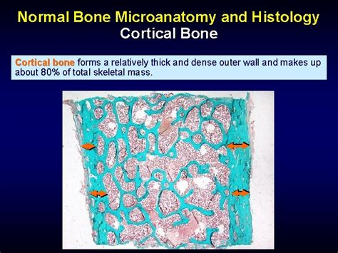 bone histology  histopathology  clinicians  primer