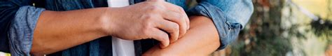 La gale : causes, symptômes et traitements | Redcare PHARMACIE