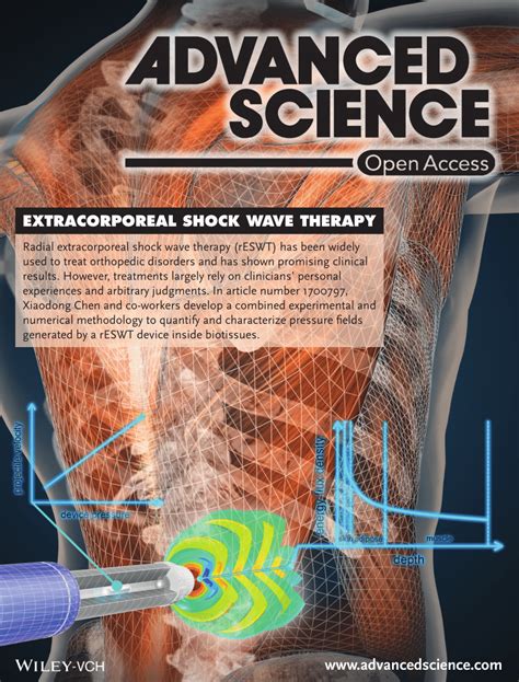 (PDF) Extracorporeal Shock Wave Therapy: Quantitative Assessments of ...