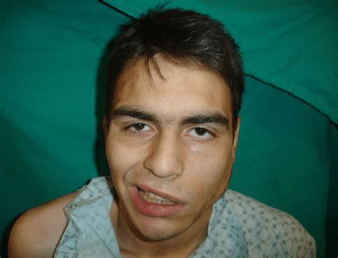 preoperative view  scientific diagram