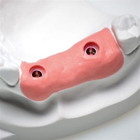 Gingifast Rigid – DOE Vietnam – Chuyên cung cấp thiết bị, vật liệu nha ...