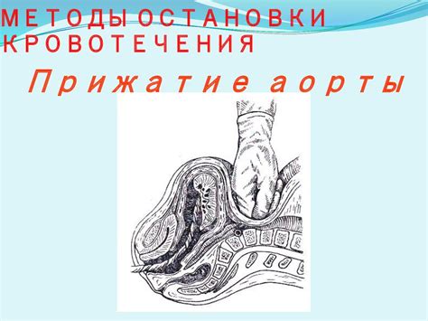 Кровотечения в последовом и раннем послеродовом периоде - презентация ...