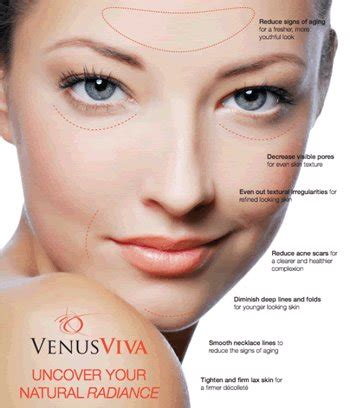 Venus Viva facial remodeling at Vedas Medical Spa and Wellness Center