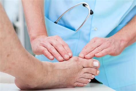 Bunions | Twin Cities Foot & Ankle Clinic | Foot Doctor