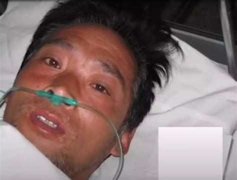Doctor revealed horrific thing he witnessed as 'radioactive man ...